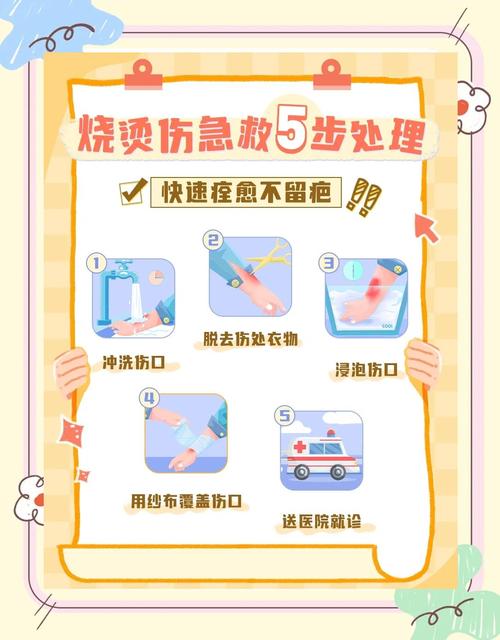 烫伤后涂牙膏？急救专家：正确处理分5步