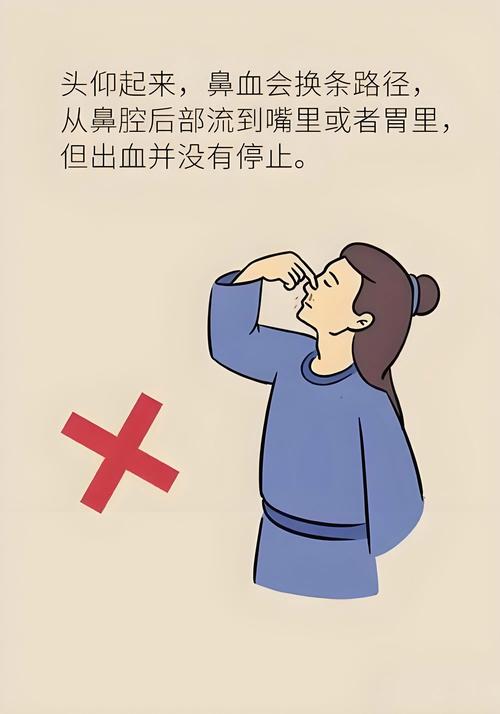 流鼻血时仰头止血？医生：正确做法是……