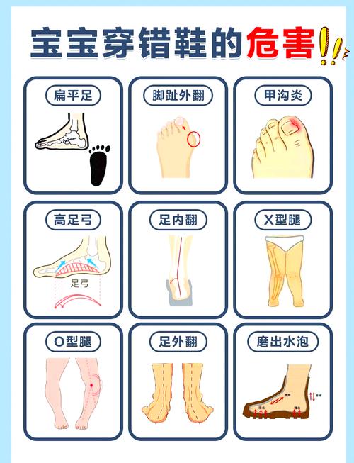 如何挑选合适的鞋子？脚部健康很重要