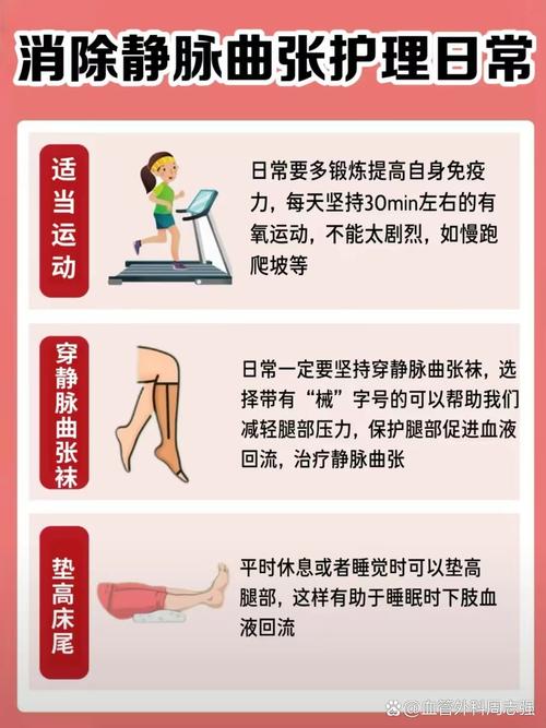 运动后立刻坐下会静脉曲张？身体护理​