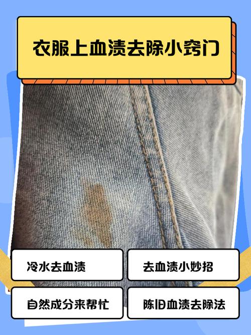 如何去除衣服上的血渍？黄金时间与处理​