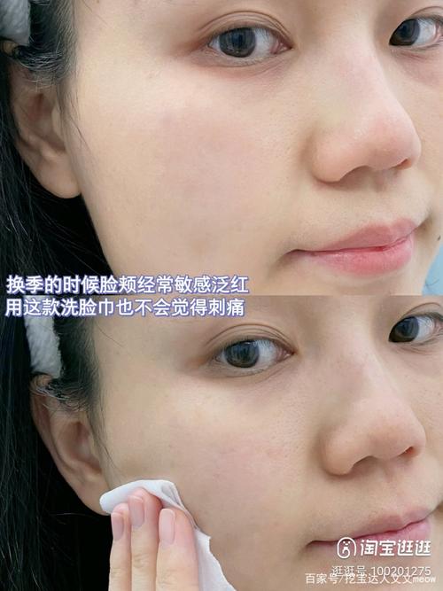 香蕉皮敷脸过敏？敏感肌实测记录