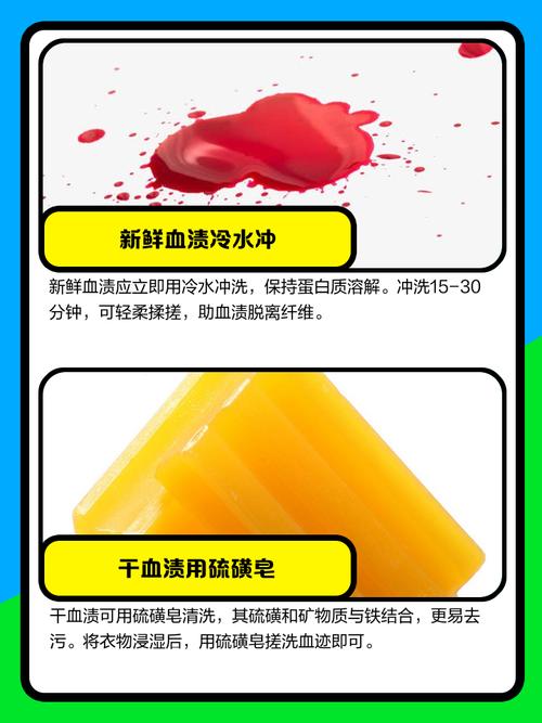 油渍、血渍、墨渍，不同污渍清除妙招