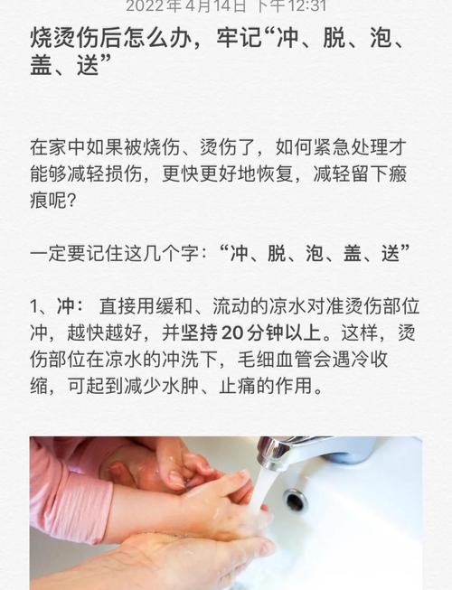 被烫伤后立即做这五步，能减轻伤害