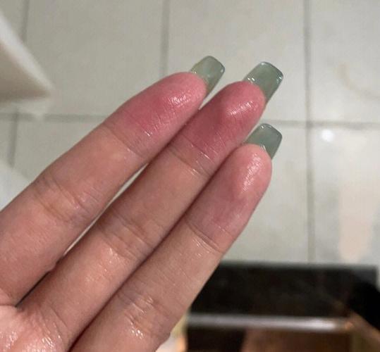 切辣椒手辣到火烧？3 种快速解辣的神奇方法​