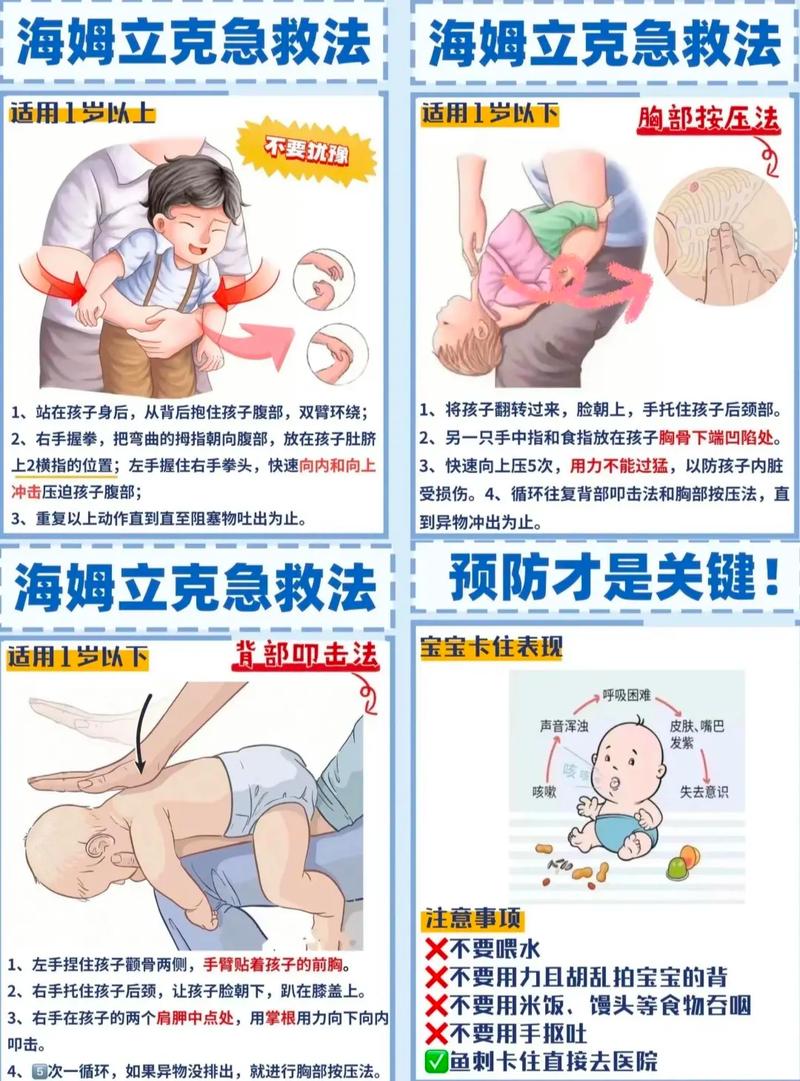 婴幼儿海姆立克法调整？背部拍击法
