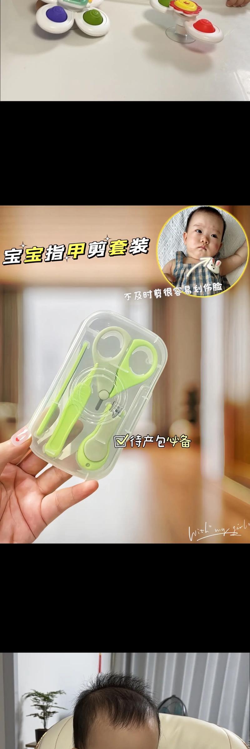 婴儿指甲剪伤肉？涂抹「碘伏 + 创可贴」