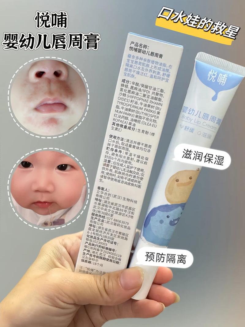 宝宝口水疹反复?涂抹「氧化锌软膏」