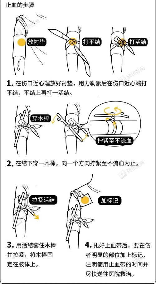 外伤出血压迫止血法